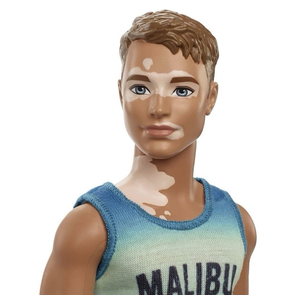 Barbie Fashionistas KEN‎ DOLL Malibu Vitiligo Skin Condition Awareness